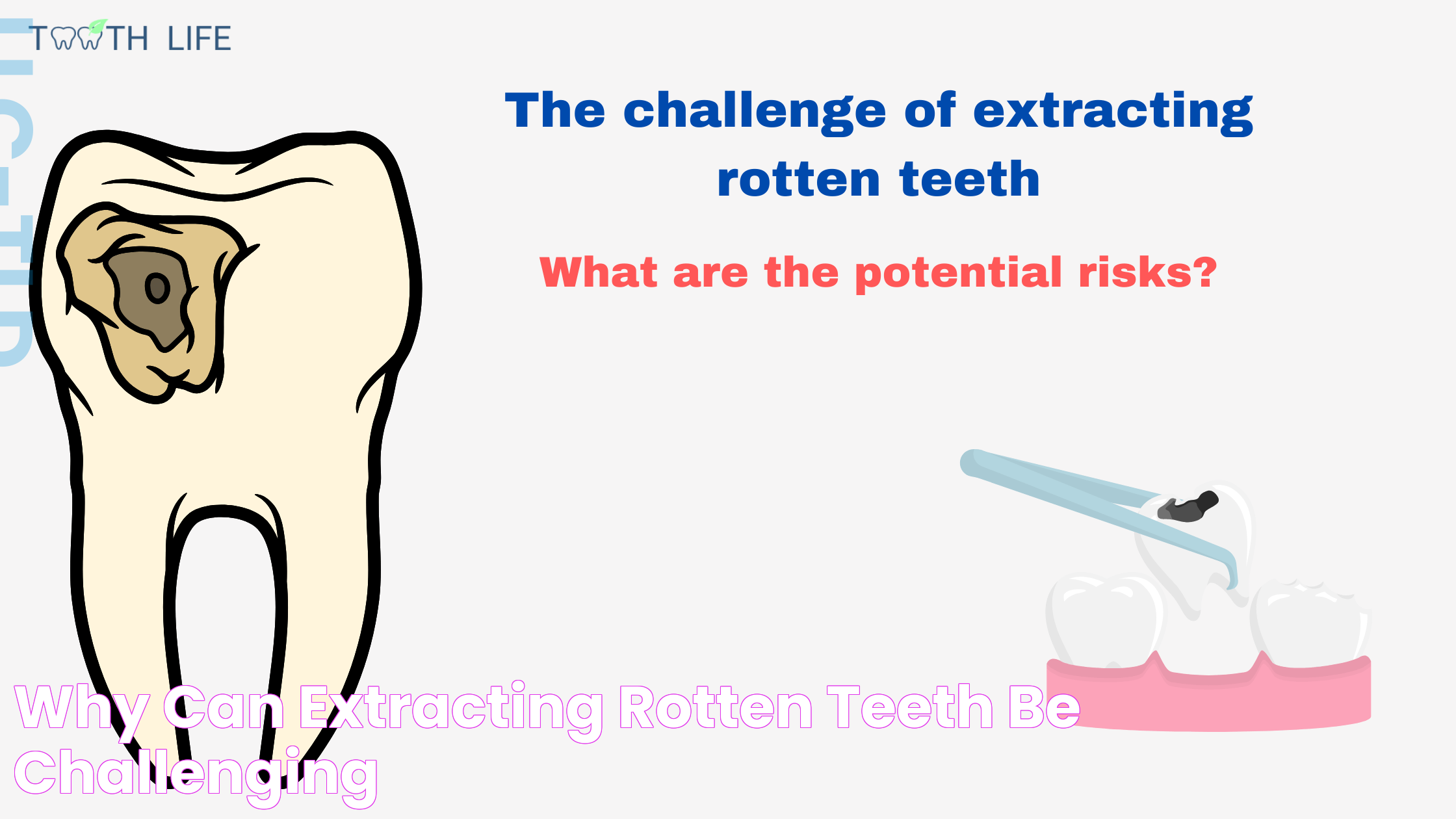 Effective Ways To Remove A Rotten Tooth At Home: A Step-by-Step Guide