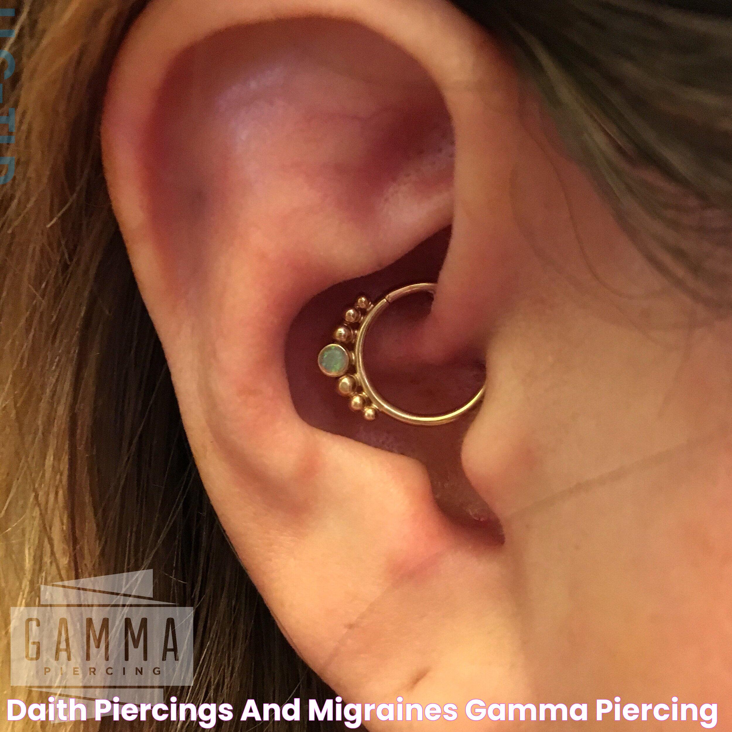 Daith Piercing For Migraines: Relief And Insights