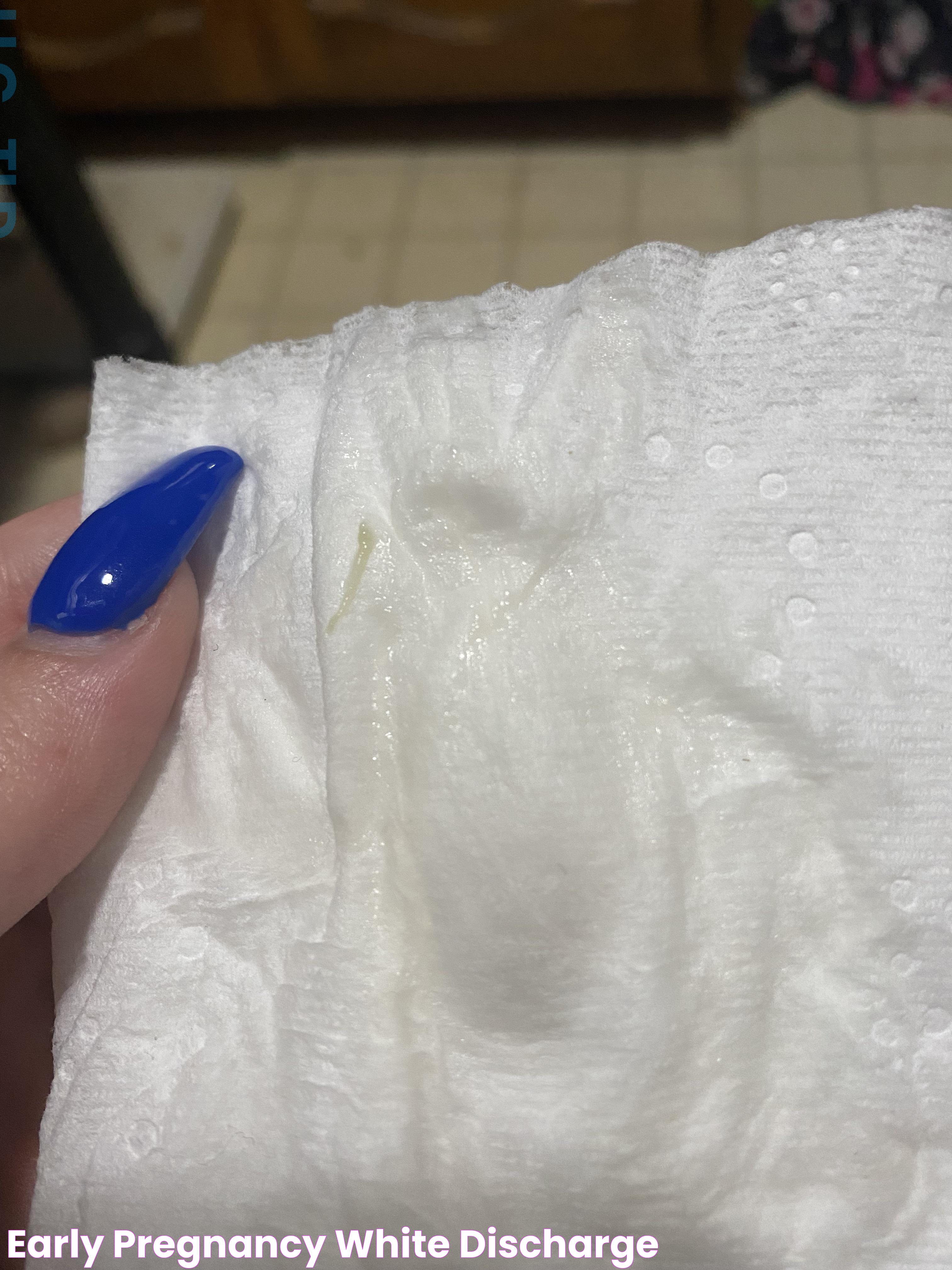 Resolving White Slimy Discharge With No Odor: A Comprehensive Guide