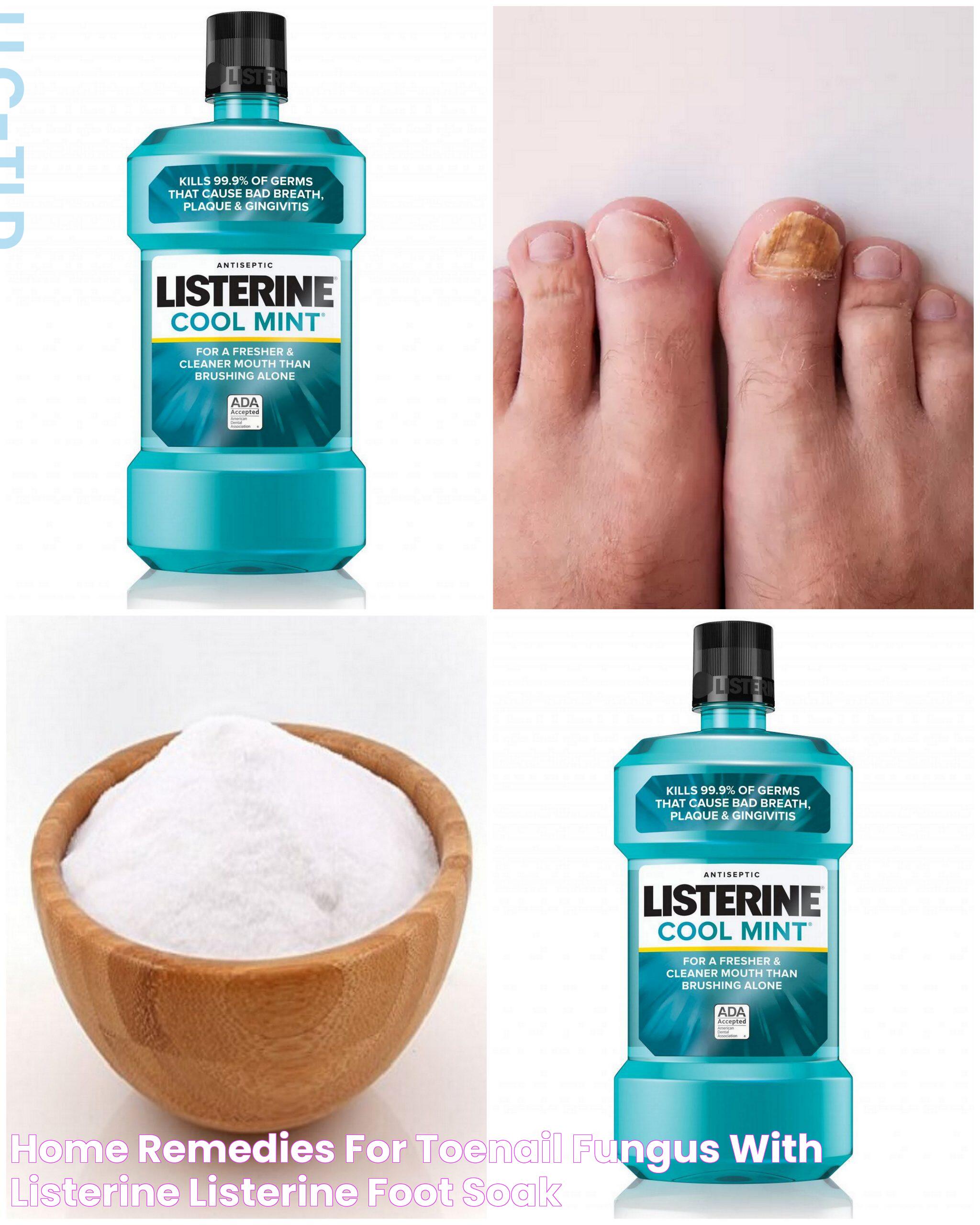 Revolutionize Your Nail Care: Listerine For Nail Fungus Treatment