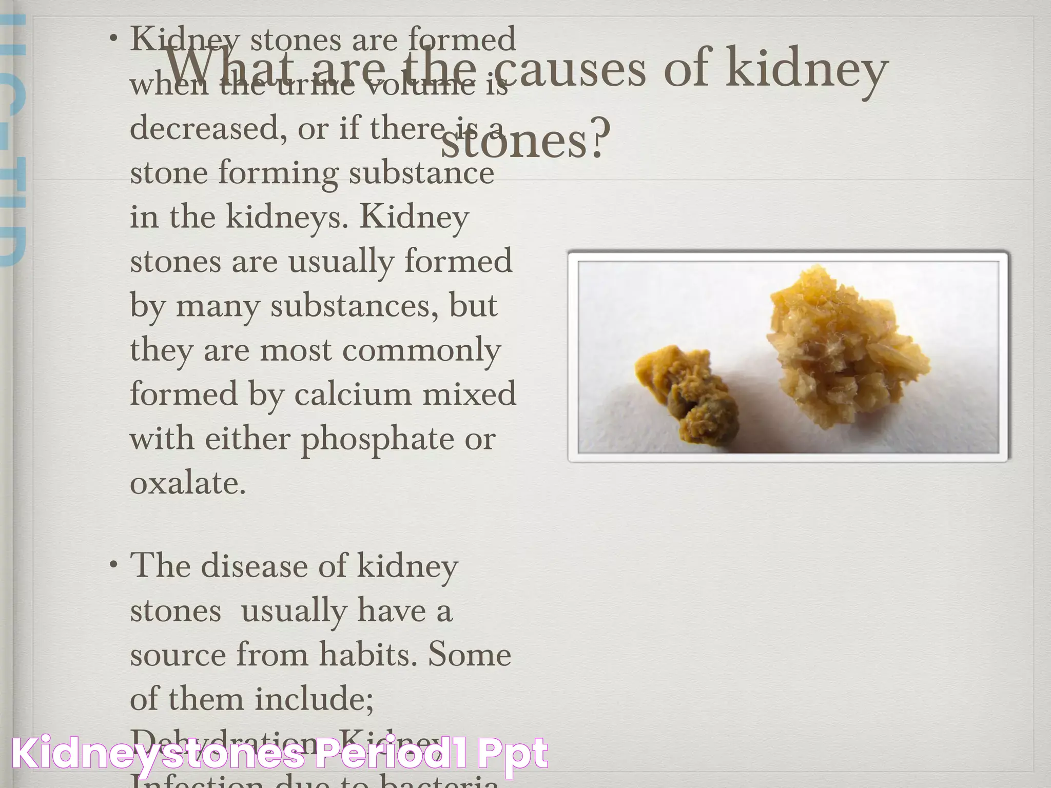 Kidney Stones And Menstrual Cycle: Challenges And Solutions