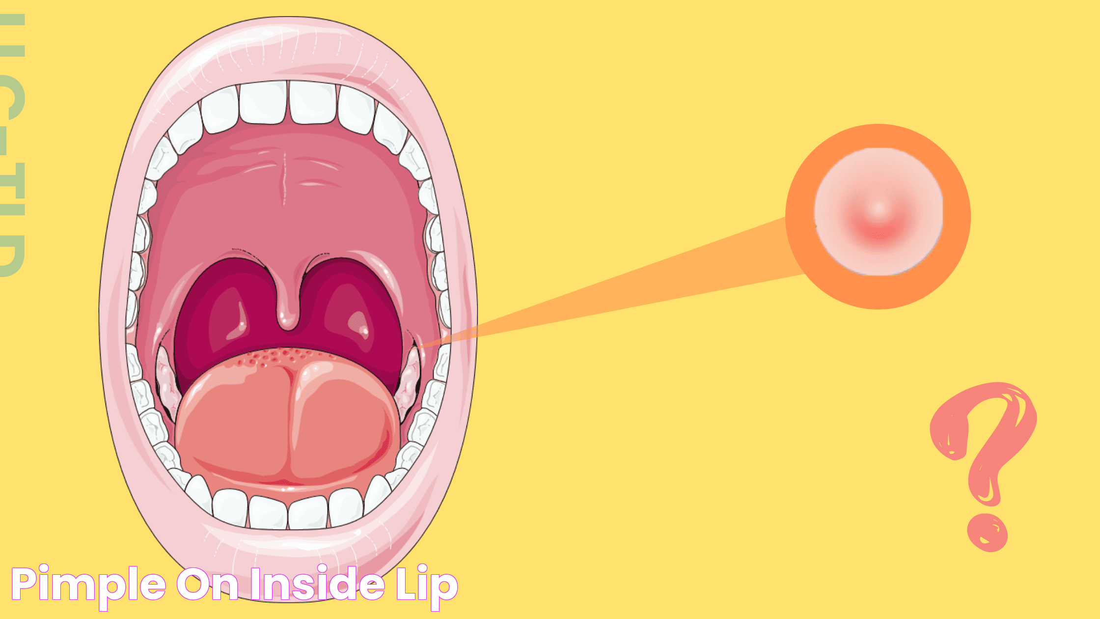 Ultimate Guide To Dealing With A Lip Pimple Inside: Tips And Solutions