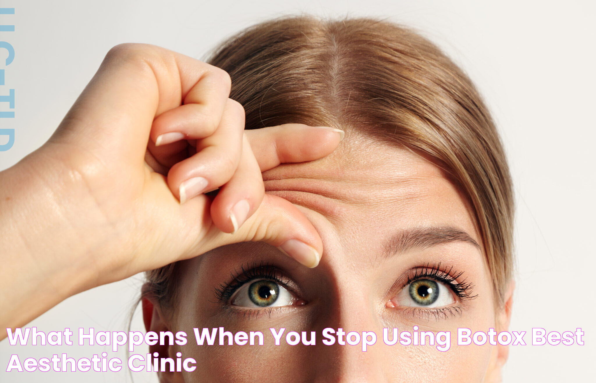 Botox Effects: What Happens When You Stop?