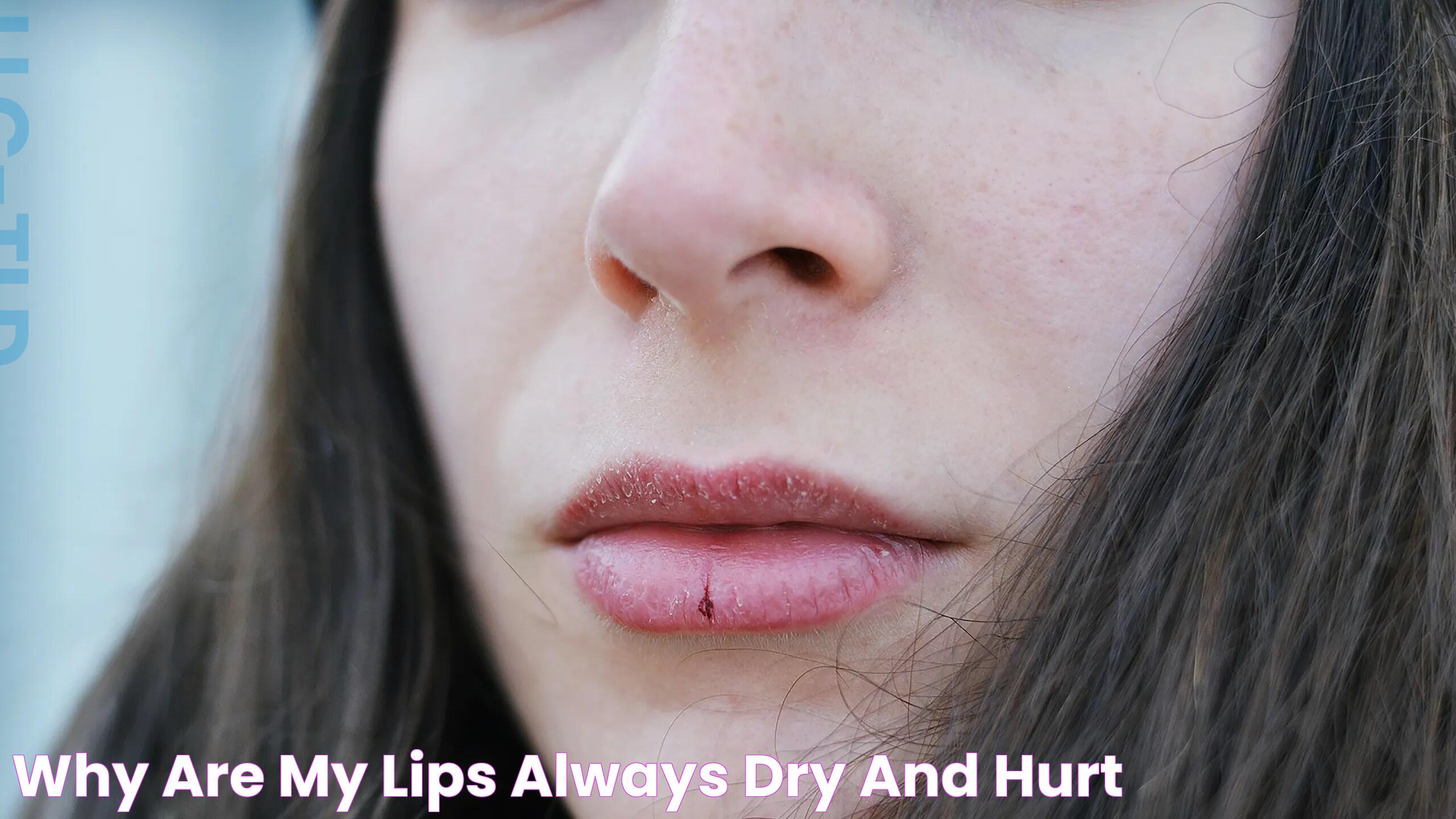 Ultimate Guide To Fixing Dry Lips Fast And Effectively