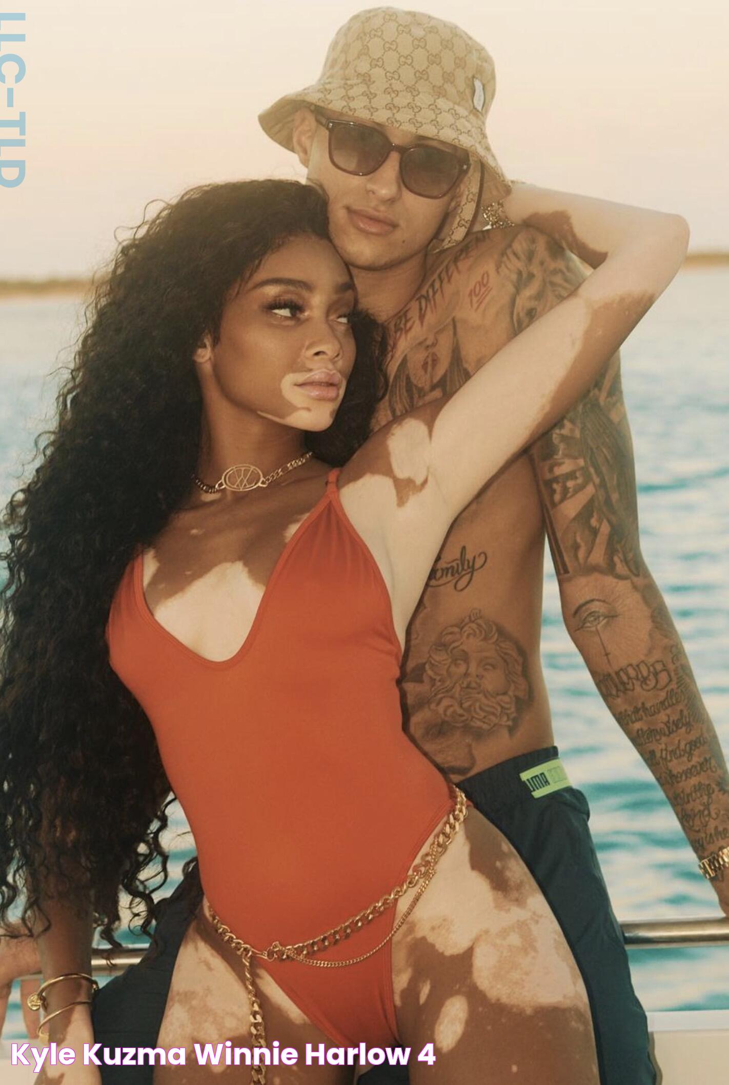 Winnie Harlow And Kyle Kuzma: A Power Couple Redefining Love And Success