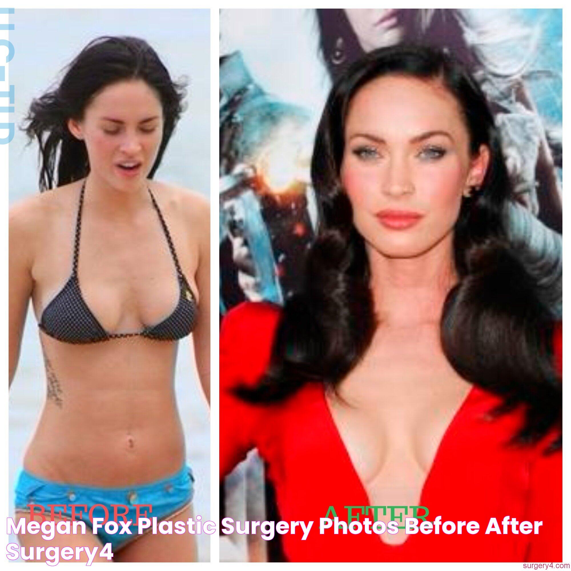 Megan Fox Surgery Before And After: A Closer Look At The Star's Transformation