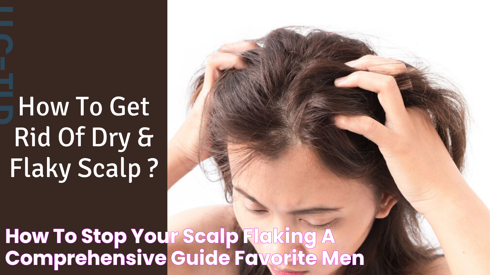 Flaking Scalp: Causes, Treatments, And Prevention Tips