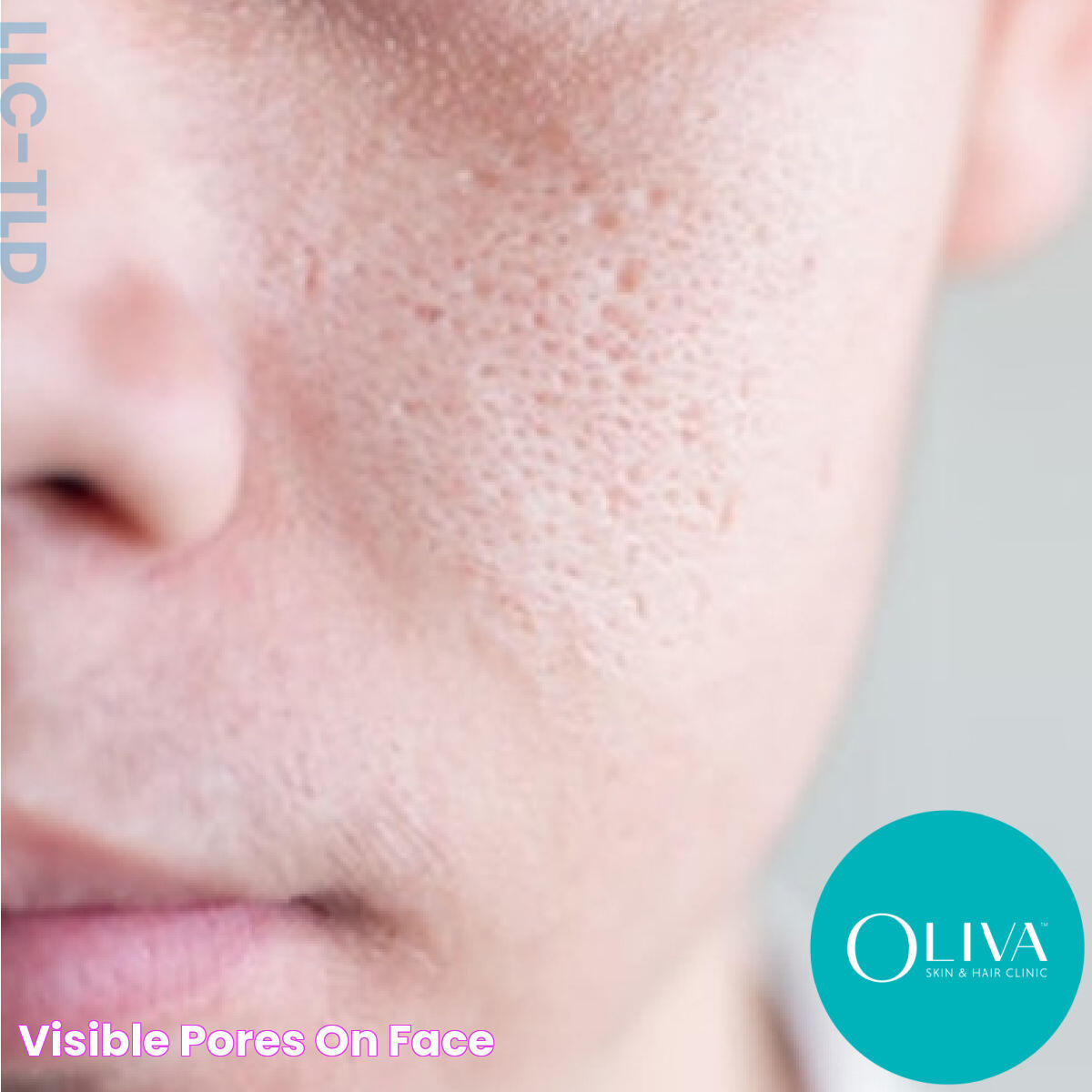 Effective Tips To Close Pores On The Face For Smooth Skin